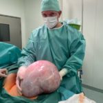 15-kilogramowy guz jajnika: przestroga, że warto robić regularne badania